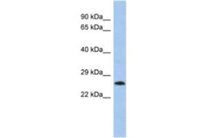 Western Blotting (WB) image for anti-MGC50273 antibody (ABIN2463949) (MGC50273 antibody)