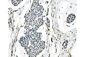 IHC analysis of splicing factor 1 using anti-splicing factor 1 antibody (ABIN7600194). (Splicing Factor 1 antibody  (AA 160-266))