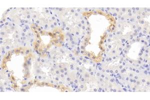 Detection of STAR in Human Kidney Tissue using Polyclonal Antibody to Steroidogenic Acute Regulatory Protein (STAR) (STAR antibody  (AA 1-285))