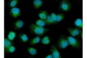 IF analysis of PDP1/PDP using anti-PDP1/PDP antibody (ABIN7601509). (PDP antibody  (AA 37-537))