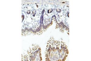 IHC analysis of TEK using anti-TEK antibody (ABIN7600762). (TEK antibody  (AA 23-616))