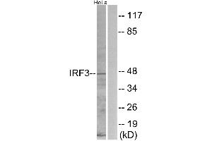 Immunohistochemistry analysis of paraffin-embedded human brain tissue using IRF3 (Ab-396) antibody. (IRF3 antibody  (Ser396))