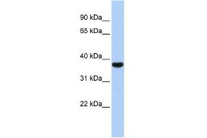 WB Suggested Anti-EXOSC2 Antibody Titration:  0. (EXOSC2 antibody  (Middle Region))