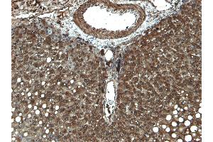 Immunohistochemistry (IHC) image for anti-Cytochrome P450, Family 3, Subfamily A, Polypeptide 4 (CYP3A4) (Internal Region) antibody (ABIN185606)