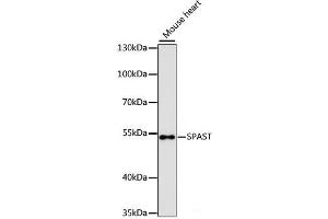 Western blot analysis of extracts of Mouse heart using SPAST Polyclonal Antibody at dilution of 1:3000. (Spastin antibody)