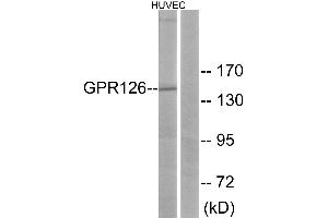 Western blot analysis of extracts from HUVEC cells, using GPR126 antibody. (G Protein-Coupled Receptor 126 antibody)