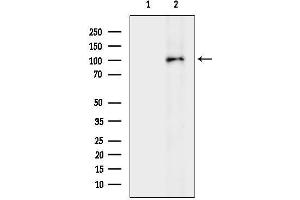 anti-Protein Kinase D3 (PRKD3) (N-Term) antibody