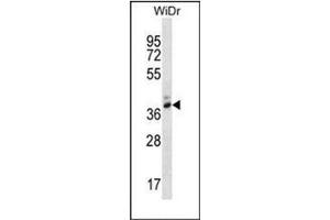 Western blot analysis of PGA4 Antibody (C-term) in WiDr cell line lysates (35ug/lane). (Pepsin antibody  (C-Term))