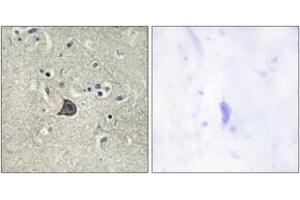 Immunohistochemistry analysis of paraffin-embedded human brain, using PLC beta3 (Phospho-Ser537) Antibody. (PLCB3 antibody  (pSer537))