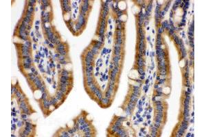 CDCP1 was detected in paraffin-embedded sections of mouse intestine tissues using rabbit anti- CDCP1 Antigen Affinity purified polyclonal antibody (Catalog # ) at 1 µg/mL. (CDCP1 antibody  (AA 582-667))