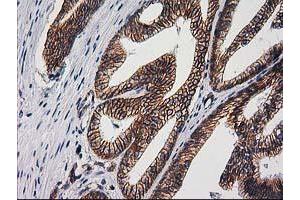 Image no. 2 for anti-Catenin (Cadherin-Associated Protein), beta 1, 88kDa (CTNNB1) antibody (ABIN1496894) (CTNNB1 antibody)