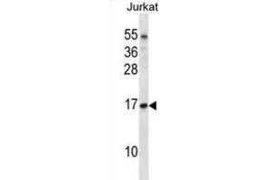 Western Blotting (WB) image for anti-Transcription Elongation Factor B (SIII), Polypeptide 1 (15kDa, Elongin C) (TCEB1) antibody (ABIN2998260) (TCEB1 antibody)