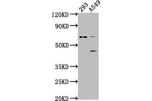 Western Blot Positive WB detected in: 293 whole cell lysate, A549 whole cell lysate All lanes: CRTAC1 antibody at 1:1000 Secondary Goat polyclonal to rabbit IgG at 1/50000 dilution Predicted band size: 72, 71, 69 kDa Observed band size: 72 kDa (CRTAC1 antibody  (AA 309-661))