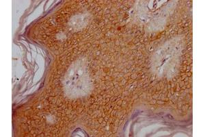 IHC image of ABIN7140024 diluted at 1:300 and staining in paraffin-embedded human skin tissue performed on a Leica BondTM system.