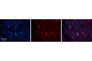 Immunohistochemistry (IHC) image for anti-Minichromosome Maintenance Deficient 4 (MCM4) (Middle Region) antibody (ABIN2774884)