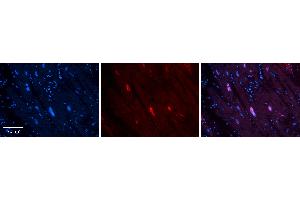 Rabbit Anti-MCM4 Antibody   Formalin Fixed Paraffin Embedded Tissue: Human heart Tissue Observed Staining: Nucleus Primary Antibody Concentration: 1:100 Other Working Concentrations: N/A Secondary Antibody: Donkey anti-Rabbit-Cy3 Secondary Antibody Concentration: 1:200 Magnification: 20X Exposure Time: 0.