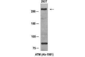 Western blot analysis of extract from 293T cells, using ATM (Ab-1981) Antibody (E021147). (ATM antibody)