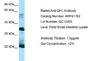 Western Blotting (WB) image for anti-Growth Hormone 1 (GH1) (C-Term) antibody (ABIN2776979) (Growth Hormone 1 antibody  (C-Term))