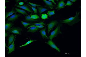 Immunofluorescence of purified MaxPab antibody to ST13 on HeLa cell. (HSC70 Interacting Protein HIP antibody  (AA 1-369))
