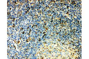 Anti-CCR3 antibody, IHC(P) IHC(P): Human Tonsil Tissue (CCR3 antibody  (N-Term))