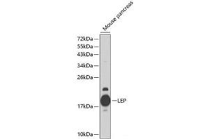 Western blot analysis of extracts of Mouse pancreas using LEP Polyclonal Antibody at dilution of 1:1000.