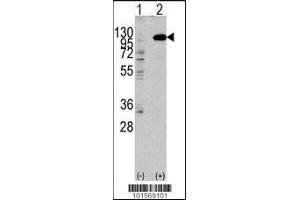 Western Blotting (WB) image for anti-Fibroblast Growth Factor Receptor 2 (FGFR2) (AA 794-821), (C-Term) antibody (ABIN5534380)