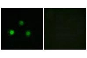 Immunofluorescence analysis of HUVEC cells, using MSH2 antibody. (MSH2 antibody)