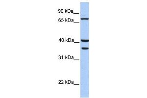 Western Blotting (WB) image for anti-Transglutaminase 5 (TGM5) antibody (ABIN2459269)