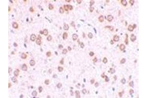 Immunohistochemistry of TLR5 in rat brain tissue with this product at 10 μg/ml. (TLR5 antibody  (Center))