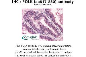 Image no. 1 for anti-Polymerase (DNA Directed) kappa (POLK) (AA 817-830) antibody (ABIN1738191) (POLK antibody  (AA 817-830))