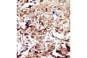 Image no. 2 for anti-phosphoenolpyruvate Carboxykinase 2 (Mitochondrial) (PEPCK) (N-Term) antibody (ABIN360567)