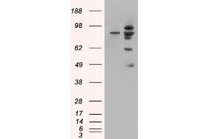 Western Blotting (WB) image for anti-Mdm2, p53 E3 Ubiquitin Protein Ligase Homolog (Mouse) (MDM2) (Internal Region) antibody (ABIN185508)