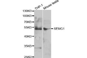 Western Blotting (WB) image for anti-Semenogelin I (SEMG1) antibody (ABIN1876675)