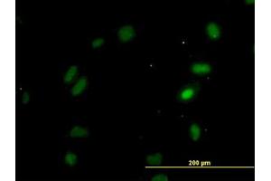 Image no. 4 for anti-Oxidative-Stress Responsive 1 (OXSR1) (AA 1-528) antibody (ABIN599106) (OXSR1 antibody  (AA 1-528))