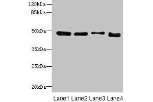 Western blot All lanes: DDI2 antibody at 4 μg/mL Lane 1: A431 whole cell lysate Lane 2: HL60 whole cell lysate Lane 3: K562 whole cell lysate Lane 4: Caco-2 whole cell lysate Secondary Goat polyclonal to rabbit IgG at 1/10000 dilution Predicted band size: 45, 24, 47 kDa Observed band size: 47 kDa (DDI2 antibody  (AA 1-211))