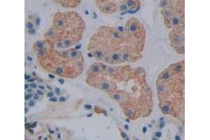 Used in DAB staining on fromalin fixed paraffin- embedded Kidney tissue (ADAP2 antibody  (AA 49-361))