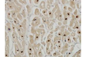Immunoperoxidase of monoclonal antibody to TTN on formalin-fixed paraffin-embedded human heart. (Titin antibody  (AA 1-110))