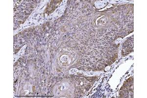 IHC analysis of ERLIN2 using anti-ERLIN2 antibody (ABIN7602582). (ERLIN2 antibody  (AA 87-339))