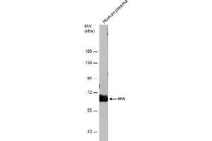 WB Image Human tissue extract (30 μg) was separated by 7. (PLAT antibody)