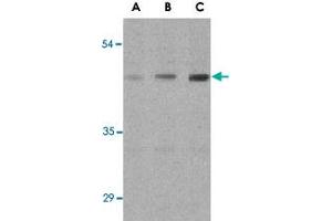 Western blot analysis of ANTXR1 in HepG2 cell lysates with ANTXR1 polyclonal antibody  at (A) 0.