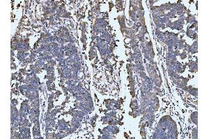 IHC analysis of LARP1 using anti-LARP1 antibody (ABIN7599861).