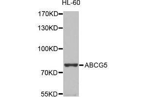 Western blot analysis of extracts of HL-60 cells, using ABCG5 antibody (ABIN5996193) at 1/1000 dilution. (ABCG5 antibody)