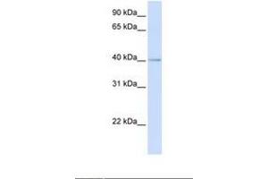 Image no. 1 for anti-Mitochondrial Ribosomal Protein L39 (MRPL39) (AA 38-87) antibody (ABIN6738234) (MRPL39 antibody  (AA 38-87))