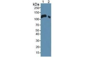 Rabbit Detection antibody from the kit in WB with Positive Control:  Sample Sample: Lane1: Mouse Serum; Lane2: Mouse Placenta Tissue.