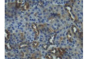 DAB staining on IHC-P; Samples: Mouse Kidney Tissue (IGFBP3 antibody  (AA 152-292))