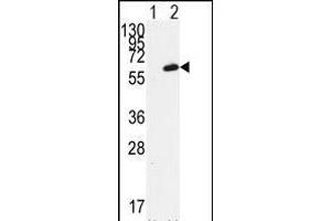 Western blot analysis of FGR (arrow) using FGR Antibody (N-term) (ABIN392096 and ABIN2841848).