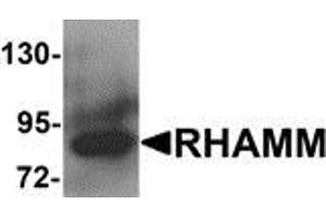 Western blot analysis of RHAMM in rat stomach tissue lysate with RHAMM antibody at 1 μg/ml. (HMMR antibody  (N-Term))