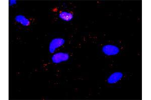 Proximity Ligation Analysis of protein-protein interactions between STAT5A and CTLA4. (STAT5A antibody  (AA 1-794))