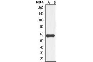 Western blot analysis of GDF9 expression in HL60 (A) whole cell lysates. (GDF9 antibody  (Center))