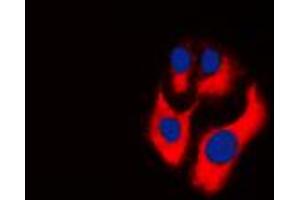 Immunofluorescent analysis of CKMT2 staining in THP1 cells. (CKMT2 antibody  (Center))